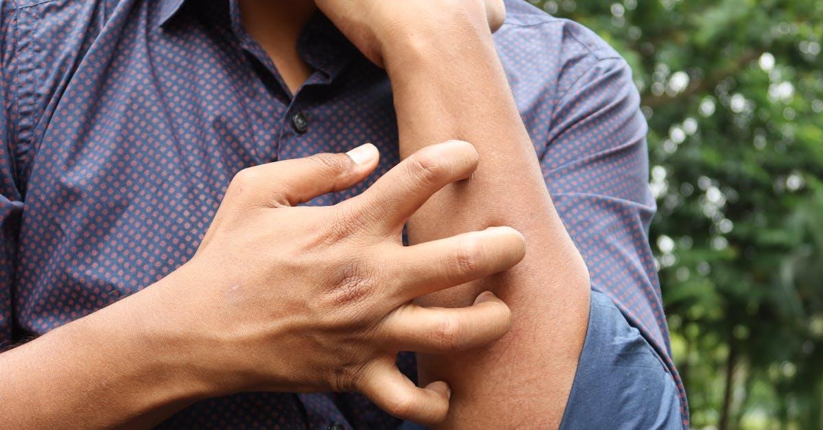 Skóra znów spokojna: nowoczesne metody leczenia i pielęgnacji przy atopowym zapaleniu skóry